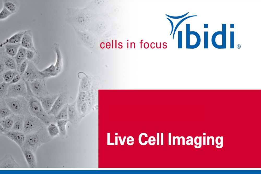 Live Cell Imaging – An Overview for Beginners