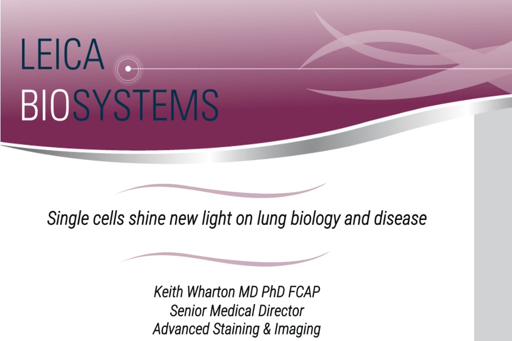 Single Cells Shine New Light on Lung Biology and Disease