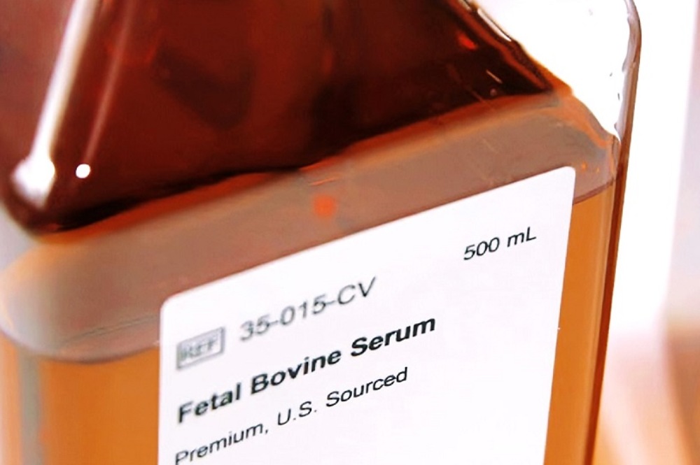 Four Key Considerations for Fetal Bovine Serum Sourcing